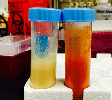 DNA extraction of environmental samples